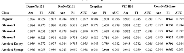 Figure 2 for DeepGleason: a System for Automated Gleason Grading of Prostate Cancer using Deep Neural Networks