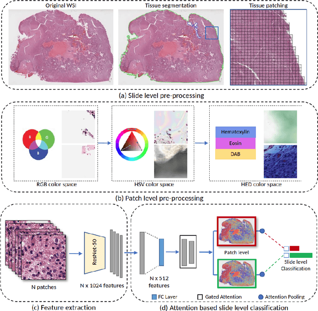 Figure 2 for Detecting Histologic Glioblastoma Regions of Prognostic Relevance