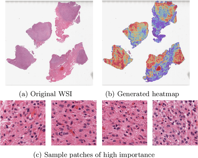Figure 4 for Detecting Histologic Glioblastoma Regions of Prognostic Relevance