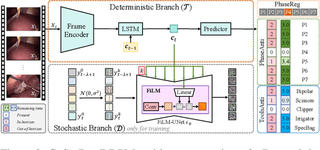 Figure 3 for CoStoDet-DDPM: Collaborative Training of Stochastic and Deterministic Models Improves Surgical Workflow Anticipation and Recognition