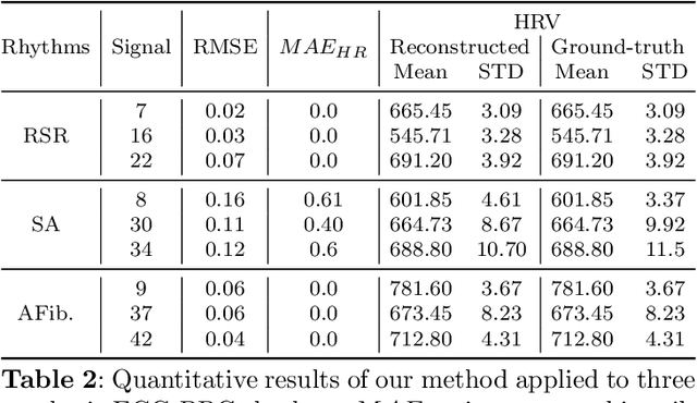 Figure 4 for CLEP-GAN: An Innovative Approach to Subject-Independent ECG Reconstruction from PPG Signals