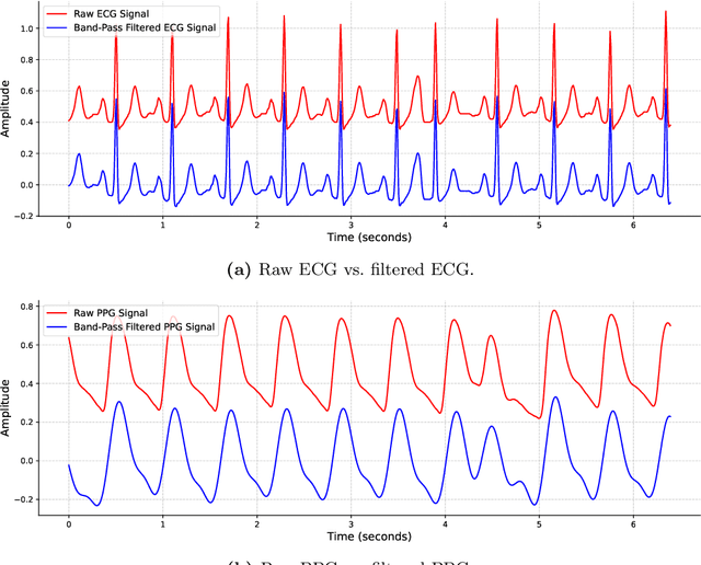 Figure 1 for CLEP-GAN: An Innovative Approach to Subject-Independent ECG Reconstruction from PPG Signals