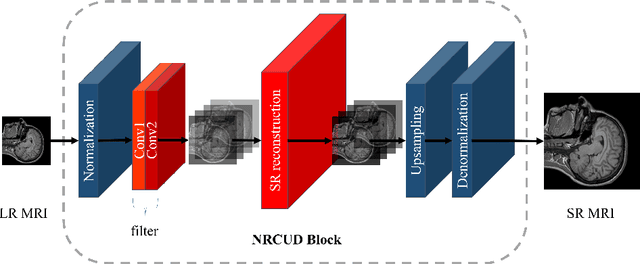 Figure 1 for Delta-WKV: A Novel Meta-in-Context Learner for MRI Super-Resolution