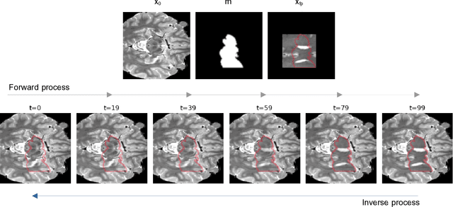 Figure 1 for DISYRE: Diffusion-Inspired SYnthetic REstoration for Unsupervised Anomaly Detection