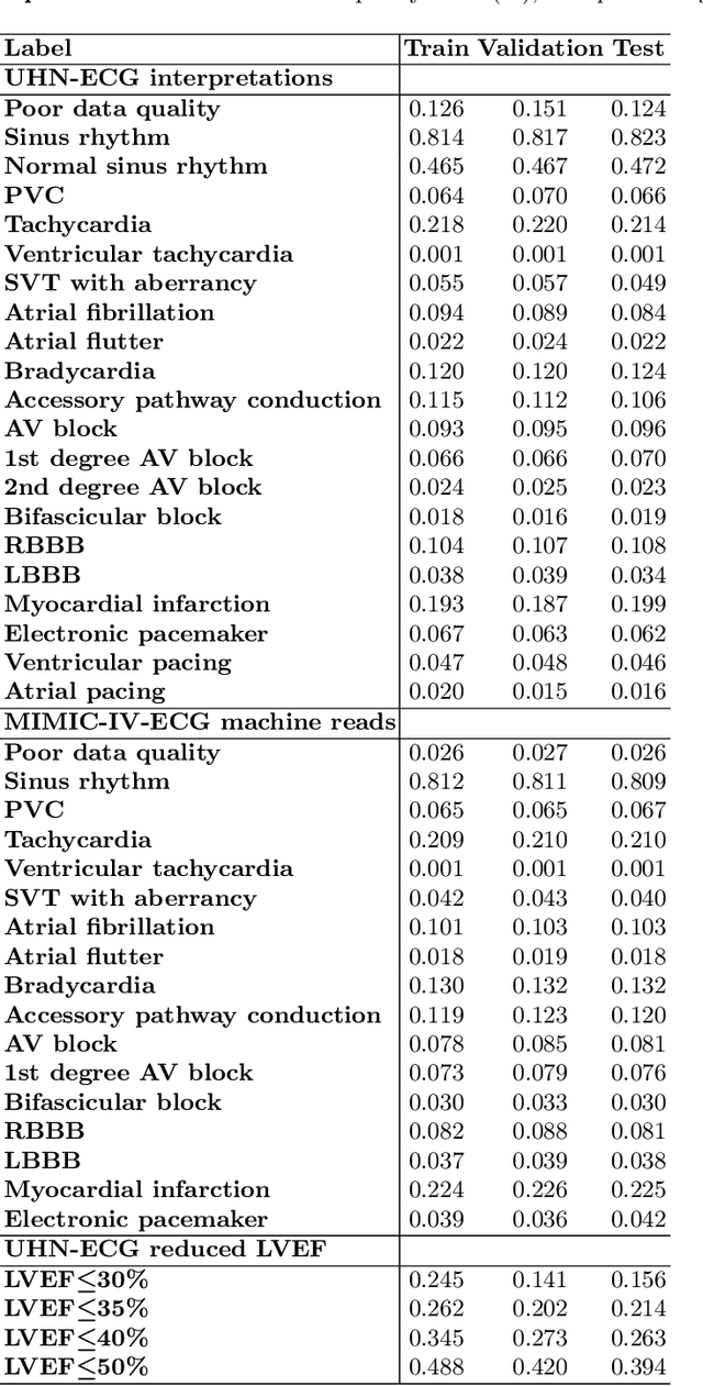 Figure 3 for ECG-FM: An Open Electrocardiogram Foundation Model