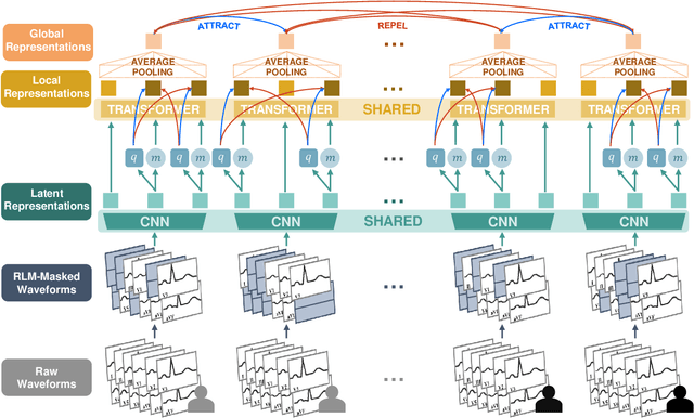 Figure 2 for ECG-FM: An Open Electrocardiogram Foundation Model