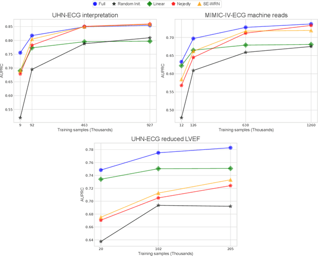 Figure 4 for ECG-FM: An Open Electrocardiogram Foundation Model