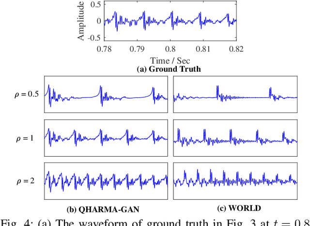 Figure 4 for QHARMA-GAN: Quasi-Harmonic Neural Vocoder based on Autoregressive Moving Average Model