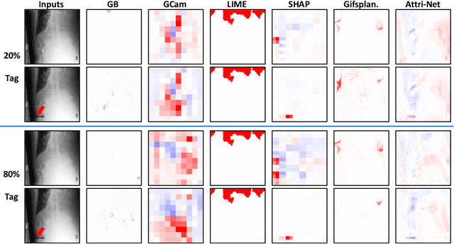 Figure 4 for Right for the Wrong Reason: Can Interpretable ML Techniques Detect Spurious Correlations?