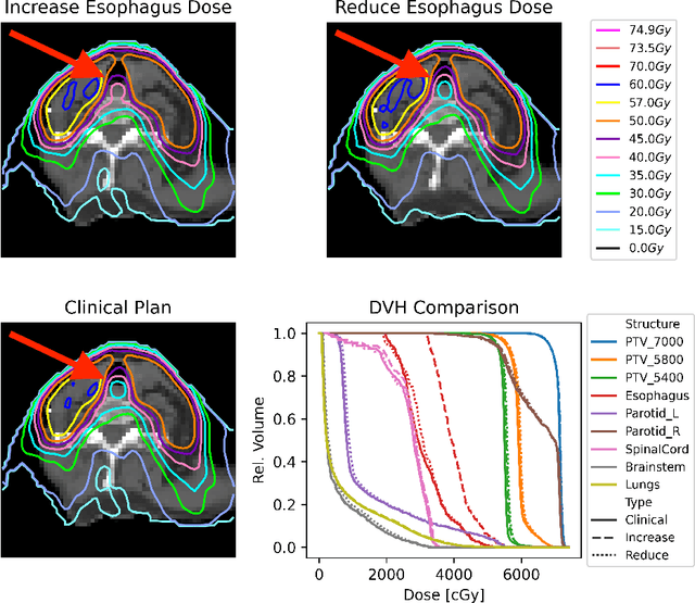 Figure 3 for Virtual Dosimetrists: A Radiotherapy Training "Flight Simulator"