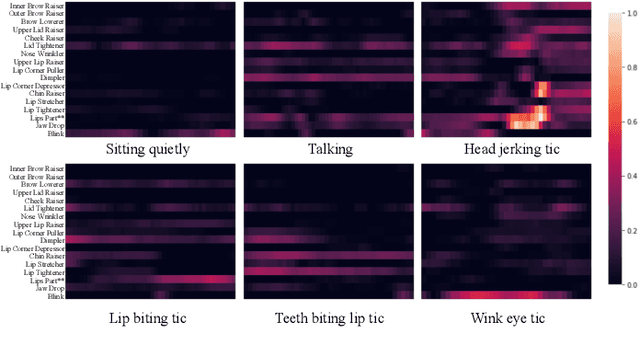 Figure 3 for Facial Tic Detection in Untrimmed Videos of Tourette Syndrome Patients