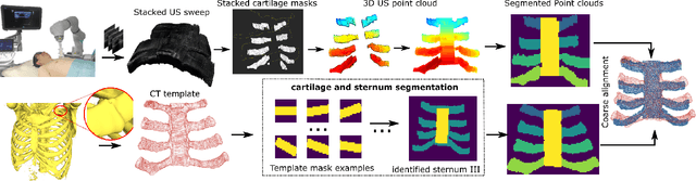 Figure 3 for Class-Aware Cartilage Segmentation for Autonomous US-CT Registration in Robotic Intercostal Ultrasound Imaging