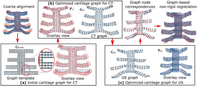 Figure 4 for Class-Aware Cartilage Segmentation for Autonomous US-CT Registration in Robotic Intercostal Ultrasound Imaging