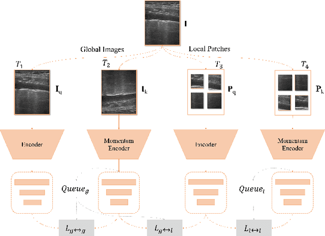 Figure 3 for A Semi-supervised Learning Approach for B-line Detection in Lung Ultrasound Images