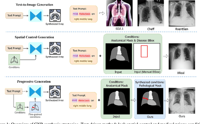 Figure 1 for AURAD: Anatomy-Pathology Unified Radiology Synthesis with Progressive Representations