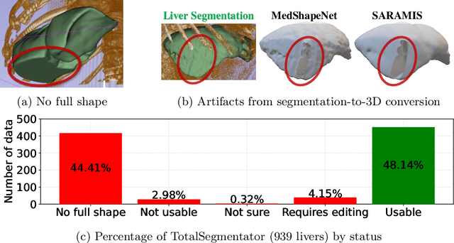 Figure 1 for Boosting 3D Liver Shape Datasets with Diffusion Models and Implicit Neural Representations