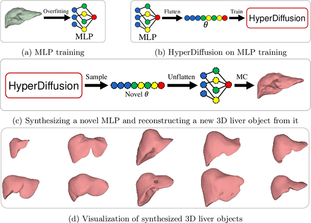 Figure 3 for Boosting 3D Liver Shape Datasets with Diffusion Models and Implicit Neural Representations