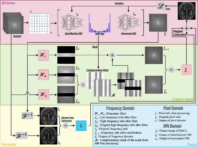 Figure 1 for DDO-IN: Dual Domains Optimization for Implicit Neural Network to Eliminate Motion Artifact in Magnetic Resonance Imaging