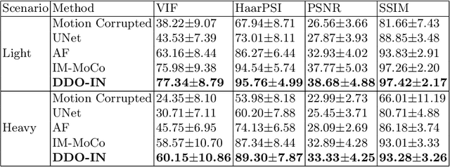 Figure 2 for DDO-IN: Dual Domains Optimization for Implicit Neural Network to Eliminate Motion Artifact in Magnetic Resonance Imaging
