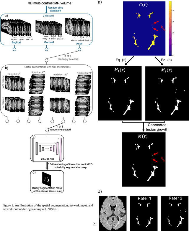 Figure 2 for UNISELF: A Unified Network with Instance Normalization and Self-Ensembled Lesion Fusion for Multiple Sclerosis Lesion Segmentation