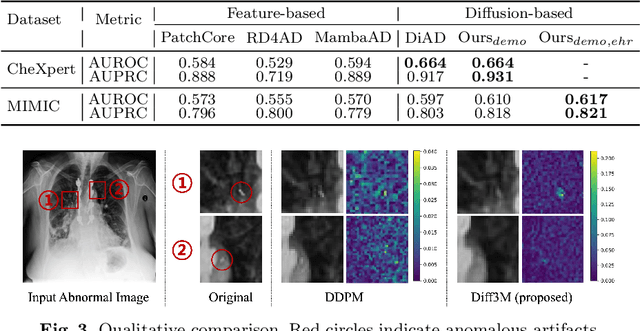 Figure 4 for Harnessing EHRs for Diffusion-based Anomaly Detection on Chest X-rays