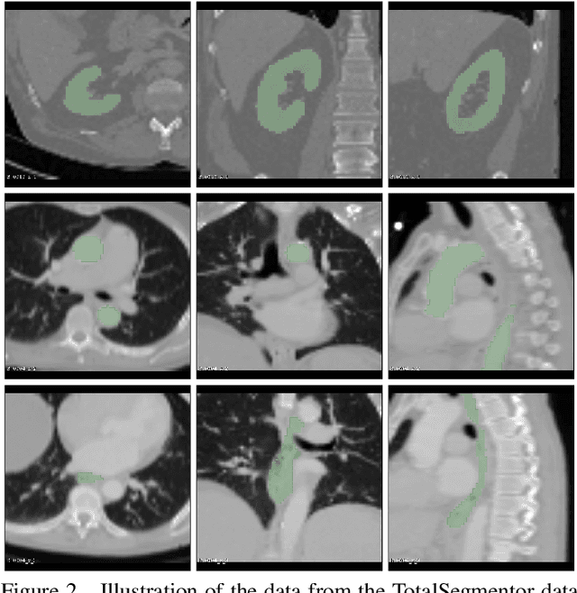 Figure 3 for Marginal Thresholding in Noisy Image Segmentation