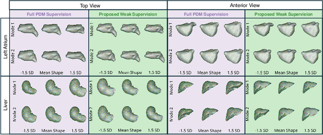 Figure 3 for Weakly Supervised Bayesian Shape Modeling from Unsegmented Medical Images