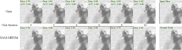 Figure 3 for Interactive Segmentation and Report Generation for CT Images