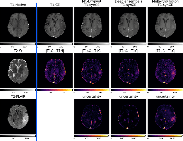 Figure 3 for Uncertainty Estimation in Contrast-Enhanced MR Image Translation with Multi-Axis Fusion