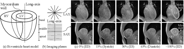 Figure 1 for Learning Volumetric Neural Deformable Models to Recover 3D Regional Heart Wall Motion from Multi-Planar Tagged MRI