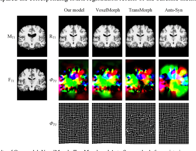 Figure 4 for A novel brain registration model combining structural and functional MRI information