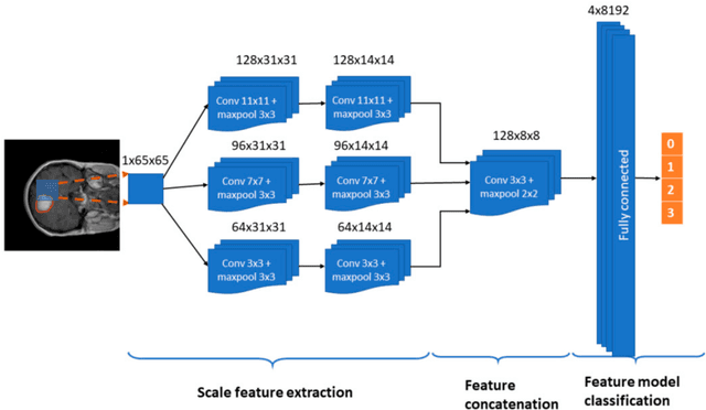 Figure 3 for A Deep Learning Approach for Brain Tumor Classification and Segmentation Using a Multiscale Convolutional Neural Network