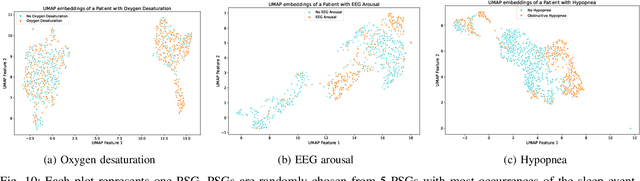 Figure 2 for PedSleepMAE: Generative Model for Multimodal Pediatric Sleep Signals