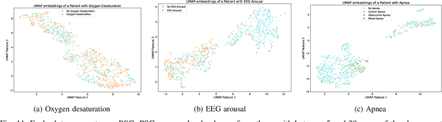 Figure 3 for PedSleepMAE: Generative Model for Multimodal Pediatric Sleep Signals