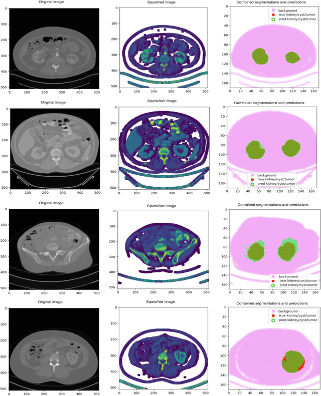 Figure 4 for Automated Segmentation of Computed Tomography Images with Submanifold Sparse Convolutional Networks