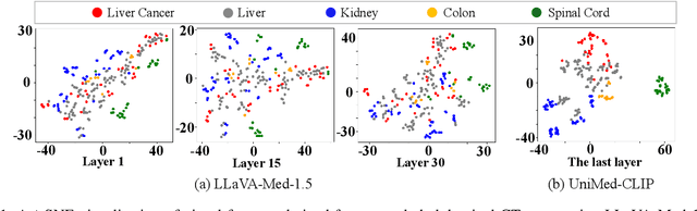 Figure 1 for Enhancing Medical Large Vision-Language Models via Alignment Distillation