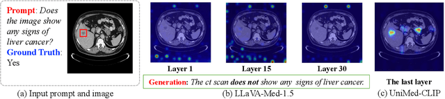 Figure 3 for Enhancing Medical Large Vision-Language Models via Alignment Distillation