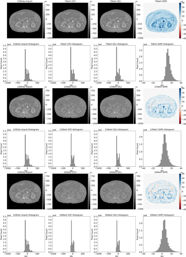 Figure 4 for Conversion of single-energy computed tomography to parametric maps of dual-energy computed tomography using convolutional neural network