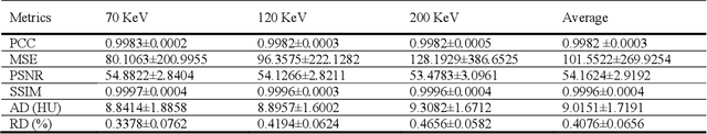 Figure 3 for Conversion of single-energy computed tomography to parametric maps of dual-energy computed tomography using convolutional neural network