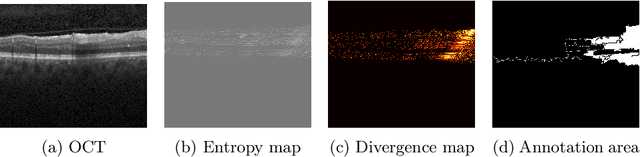 Figure 2 for EdgeAL: An Edge Estimation Based Active Learning Approach for OCT Segmentation