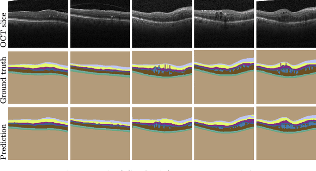 Figure 4 for EdgeAL: An Edge Estimation Based Active Learning Approach for OCT Segmentation