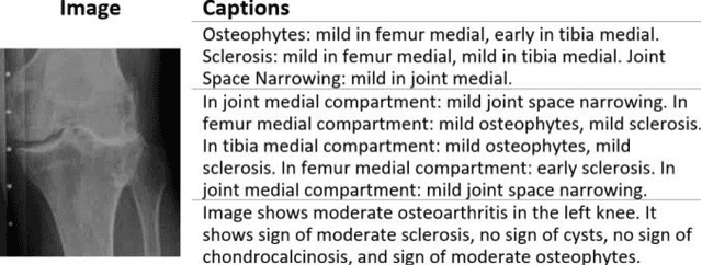 Figure 2 for Application Of Vision-Language Models For Assessing Osteoarthritis Disease Severity