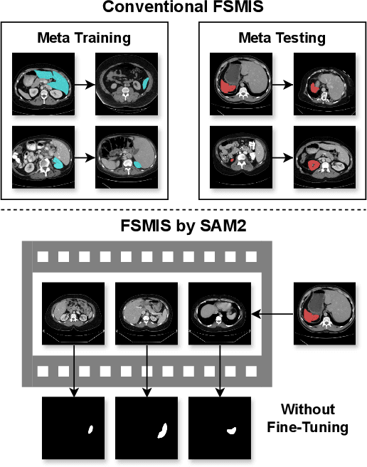 Figure 1 for Rethinking Few-Shot Medical Image Segmentation by SAM2: A Training-Free Framework with Augmentative Prompting and Dynamic Matching