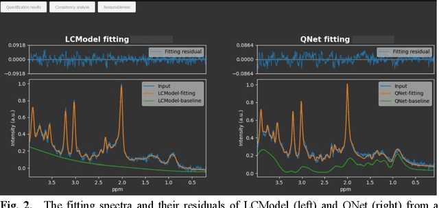 Figure 4 for An artificially intelligent magnetic resonance spectroscopy quantification method: Comparison between QNet and LCModel on the cloud computing platform CloudBrain-MRS