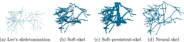 Figure 4 for Enhancing the automatic segmentation and analysis of 3D liver vasculature models