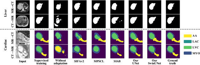 Figure 3 for Bridging the Inter-Domain Gap through Low-Level Features for Cross-Modal Medical Image Segmentation
