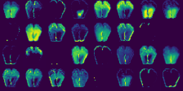 Figure 1 for Is plantar thermography a valid digital biomarker for characterising diabetic foot ulceration risk?