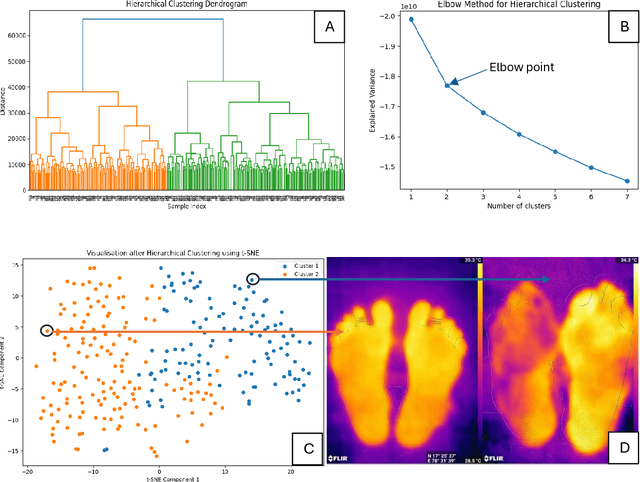 Figure 3 for Is plantar thermography a valid digital biomarker for characterising diabetic foot ulceration risk?