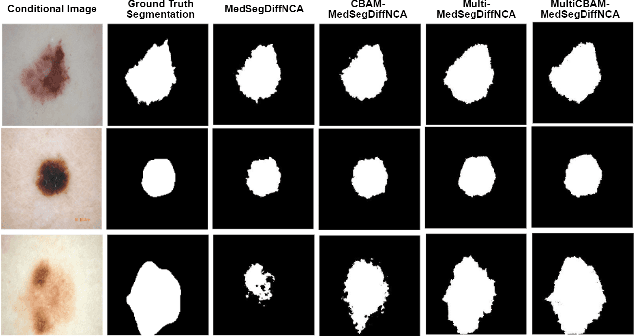 Figure 4 for MedSegDiffNCA: Diffusion Models With Neural Cellular Automata for Skin Lesion Segmentation
