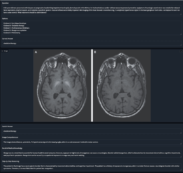 Figure 3 for Gemini Goes to Med School: Exploring the Capabilities of Multimodal Large Language Models on Medical Challenge Problems & Hallucinations